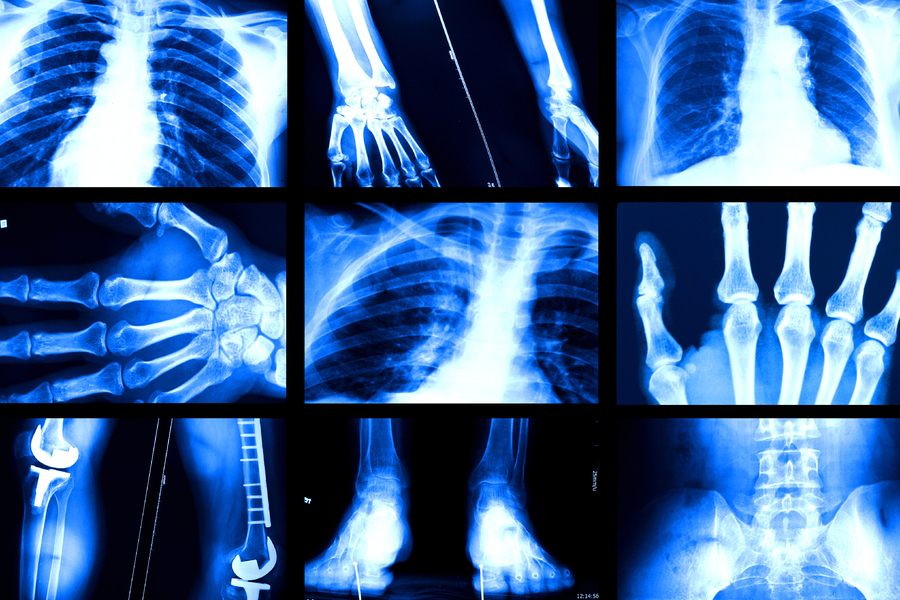 Collage of nine blue-toned X-ray images showing various skeletal structures including the chest, hands, feet, spine, and knee with a joint replacement.