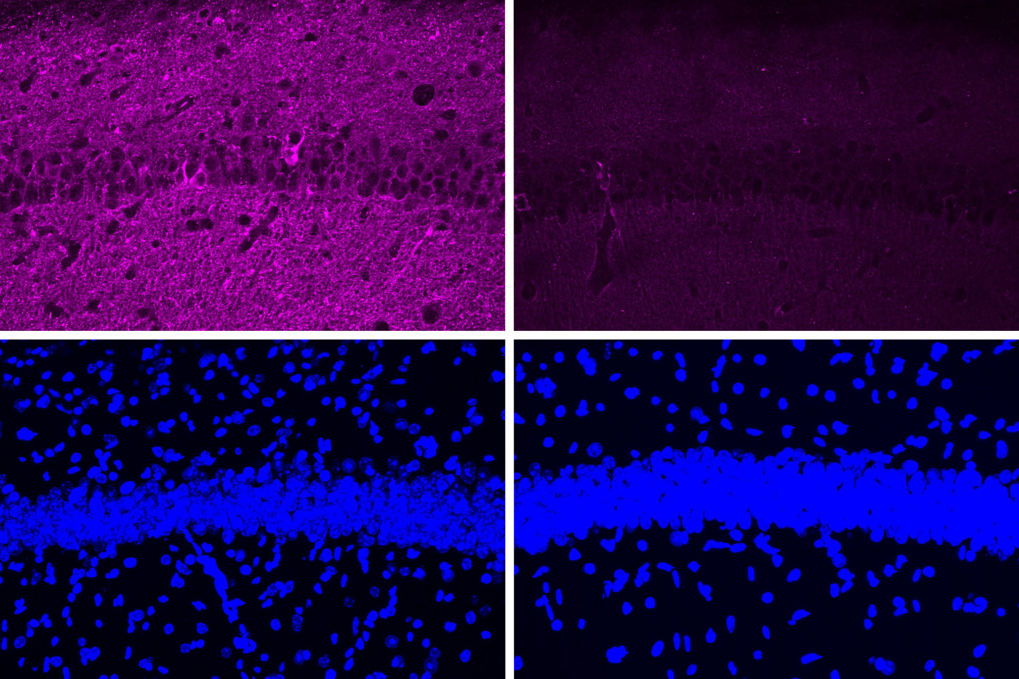 Four panels in a 2x2 array. The top left shows a lot of purple staining of cells. The top right shows much less purple. The bottom row shows two nearly identical stripes of blue with lots of blue spots above and below.
