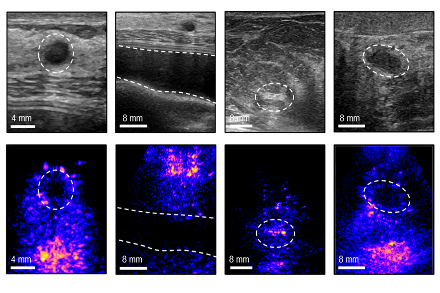 A grid of eight medical scans comparing standard grayscale ultrasounds on the top row with corresponding blue and orange color-mapped scans on the bottom row.