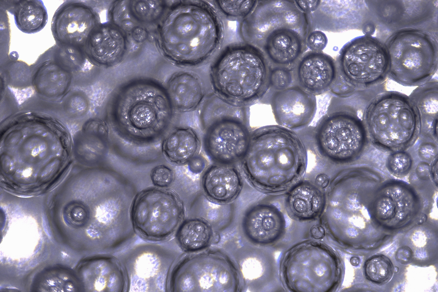 A close-up microscope image of numerous translucent spherical droplets or bubbles of varying sizes clustered together.