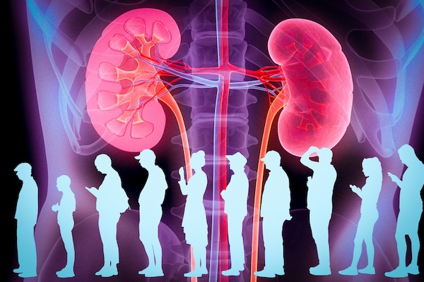 Illustration of people waiting with a large kidney icon in the background.