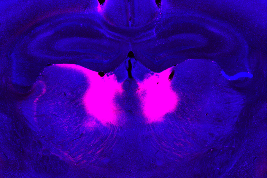 Fluorescent brain tissue image showing two bright pink regions against a deep blue background.