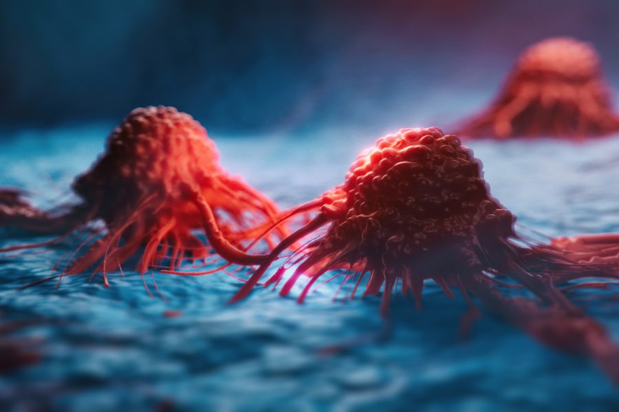 Close-up illustration of cancer cells on a blue background, showing three reddish, irregularly shaped cells with tentacle-like extensions spreading outward.