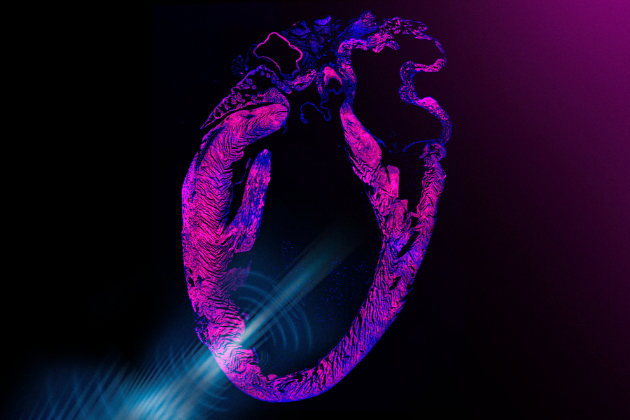 A fluorescence microscopy image of a heart cross-section in vivid purple and pink, illuminated at the bottom by a bright blue light beam.
