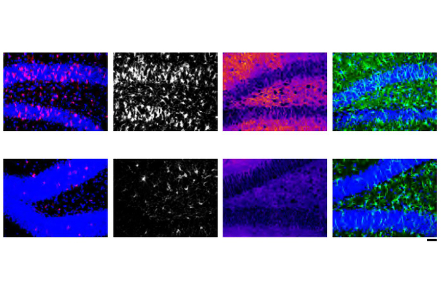 Eight-panel grid of fluorescence microscopy images of brain tissue sections shown in blue, red, white, green, and purple, comparing two experimental conditions across multiple staining channels