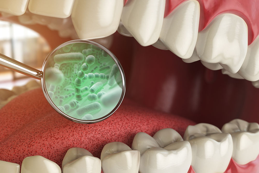3D medical illustration of an open mouth with a dental mirror magnifying glowing green oral bacteria on the teeth and gums.