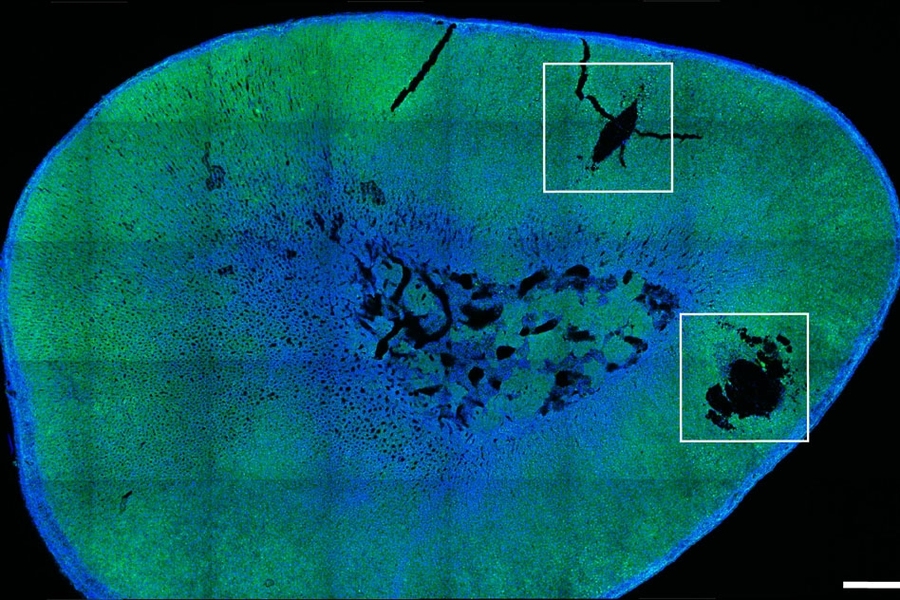 A fluorescence microscopy cross-section of biological tissue in green and blue tones with dark irregular voids, with two white rectangular insets highlighting regions of interest.