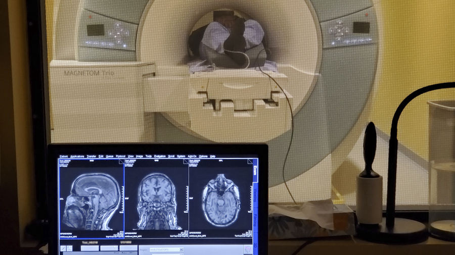 A monitor displaying three brain MRI scans sits in the foreground while a patient undergoes an MRI scan in a Magnetom Trio machine visible through a window behind it.
