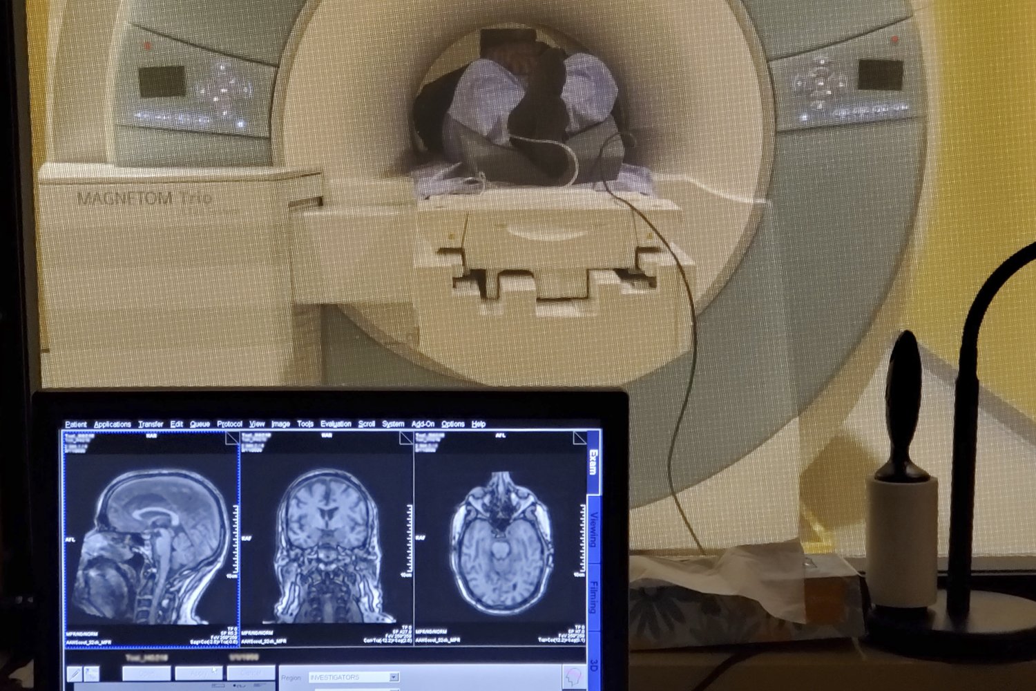 A monitor displaying three brain MRI scans sits in the foreground while a patient undergoes an MRI scan in a Magnetom Trio machine visible through a window behind it.
